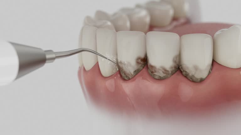 Reliable Dental Implants contractor in Niantic, CT by Smile Center Dentistry